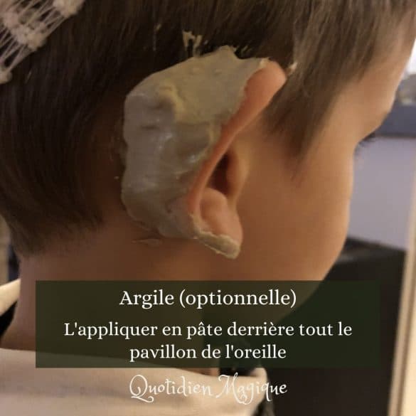 5 otite argile oreille